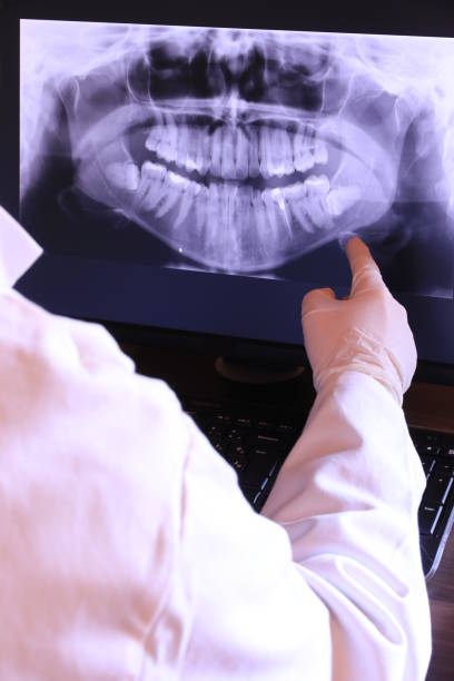 Best Dental Abscess Treatment in West Melbourne, FL