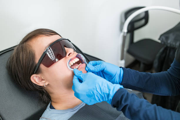 Best Knocked-Out Tooth (Avulsed Tooth) Treatment in West Melbourne, FL